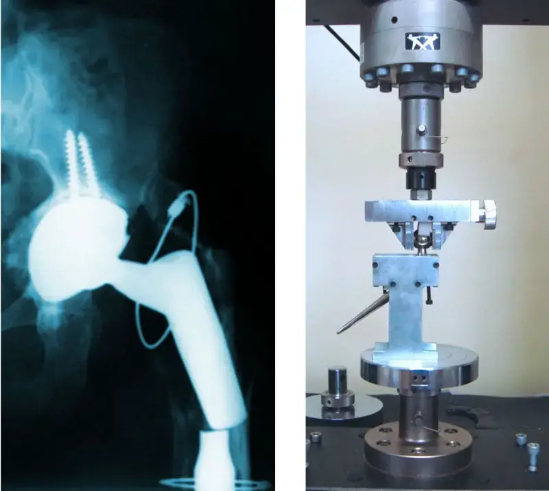 Análisis de implantes para ANVISA